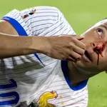 Equipe de France : une première durée d’indisponibilité tombe pour Mbappé, elle est terrible